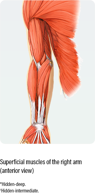 Dosing and administration for adult ULS medical diagram with an anterior view showing how to dose and administer dysport for superficial muscles of the right arm in adults with upper limb spasticity
