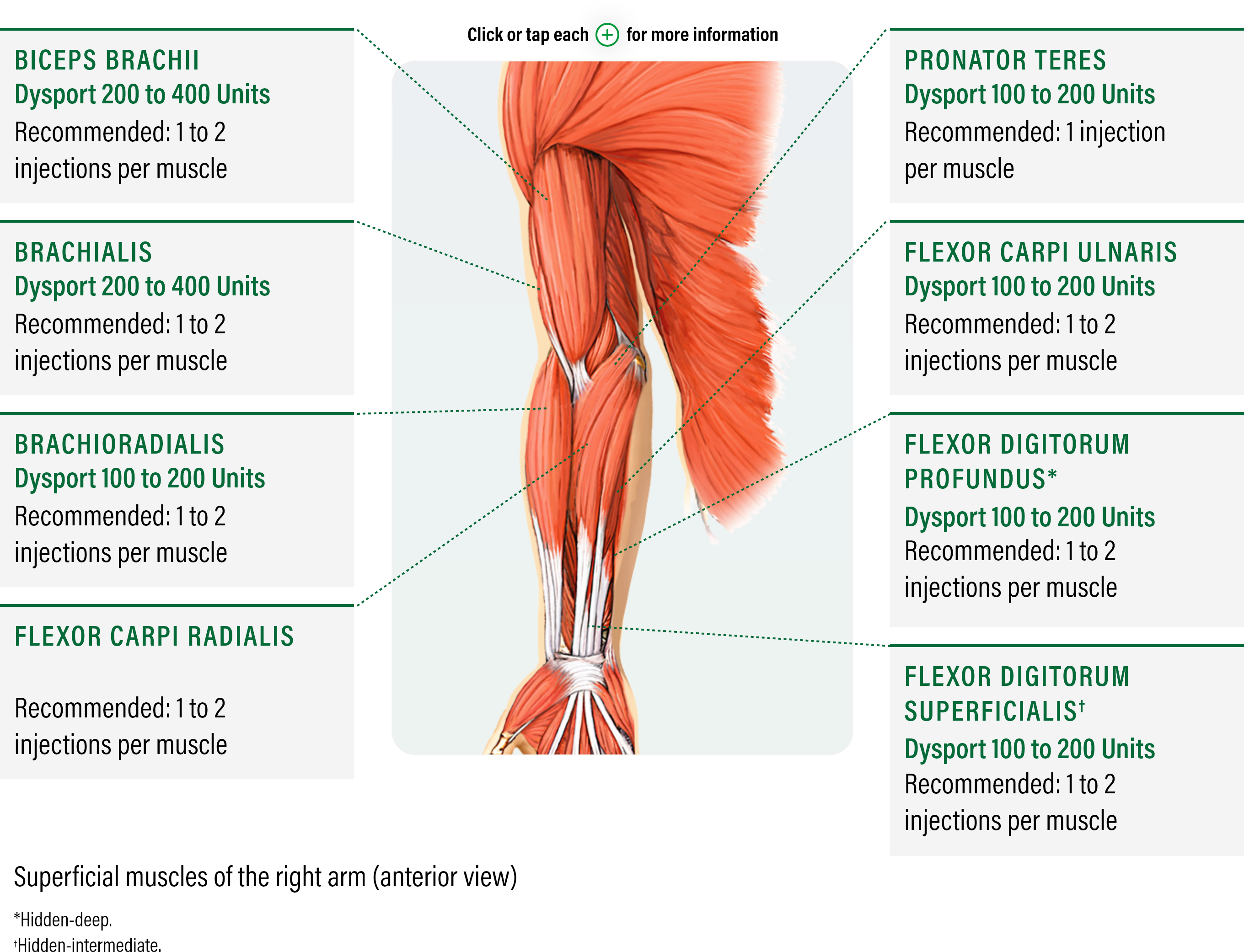 AS - Dosing-and-Administration-Widget medical diagram with an anterior view showing how to dose and administer dysport for superficial muscles of the right arm in adults with upper limb spasticity